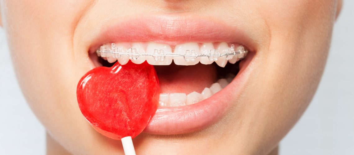 Close-up portrait of woman with orthodontic clear brackets biting off red lollipop in the shape of heart
